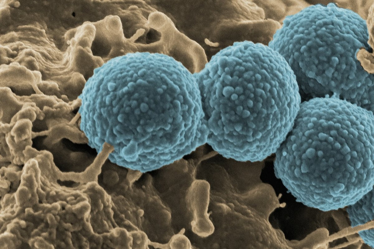 Your skin has its own universe: discover the skin microbiome